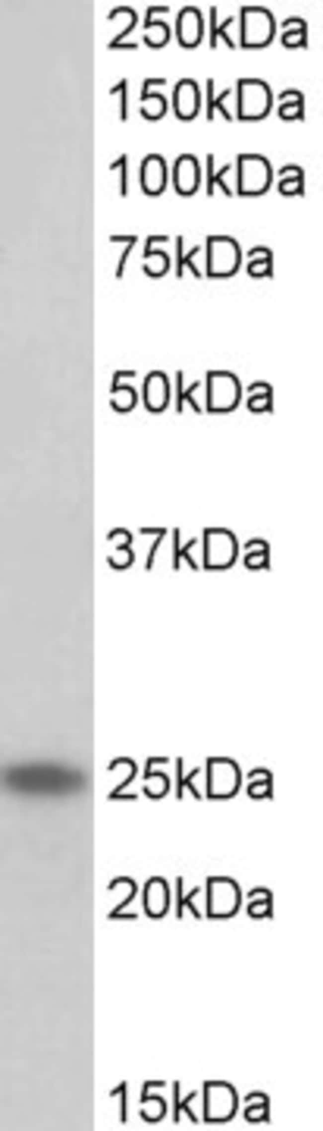 100 UG Troponin I / TNNI1 Antibody