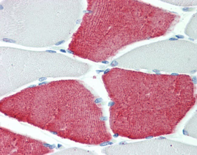100 UG Troponin T / TNNT3 Antibody