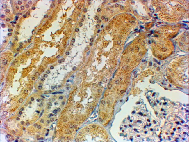100 UG Tensin-1 / TNS1 Antibody