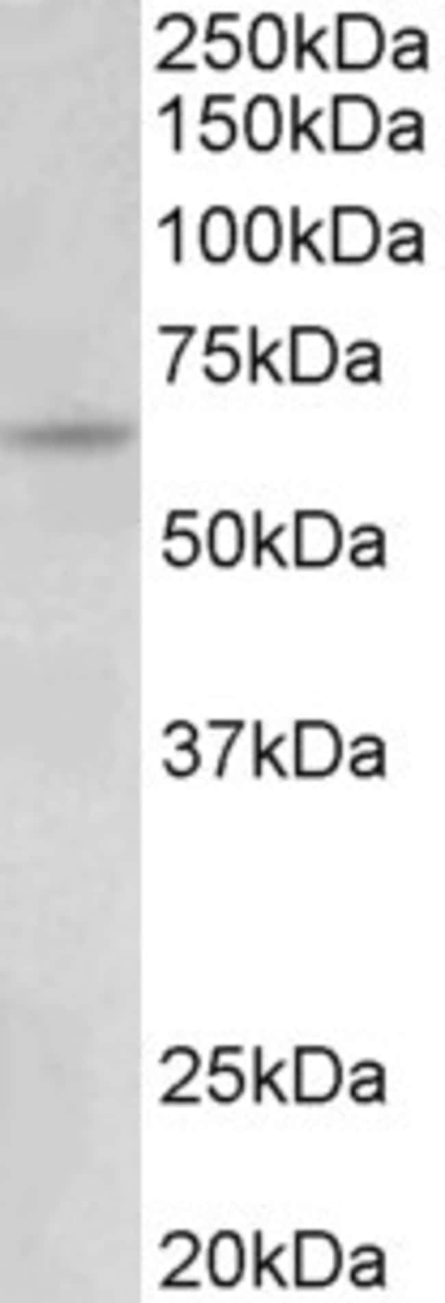 100 UG Uromodulin Antibody
