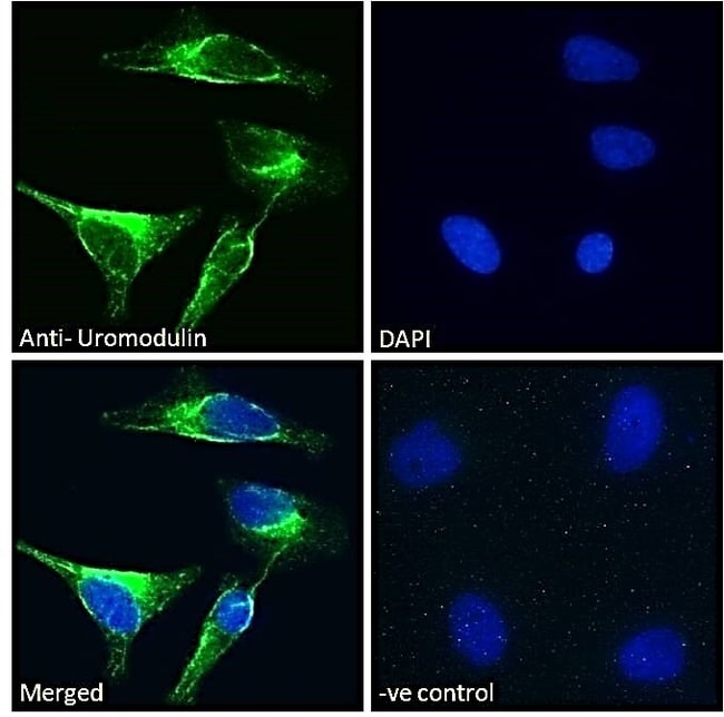 100 UG Uromodulin Antibody