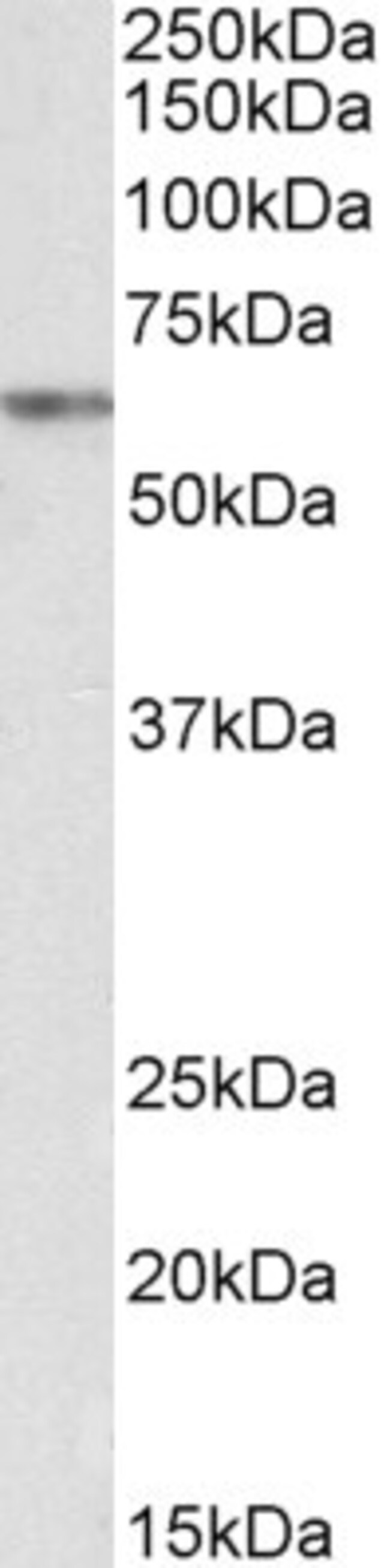 100 UG VRK2 Antibody