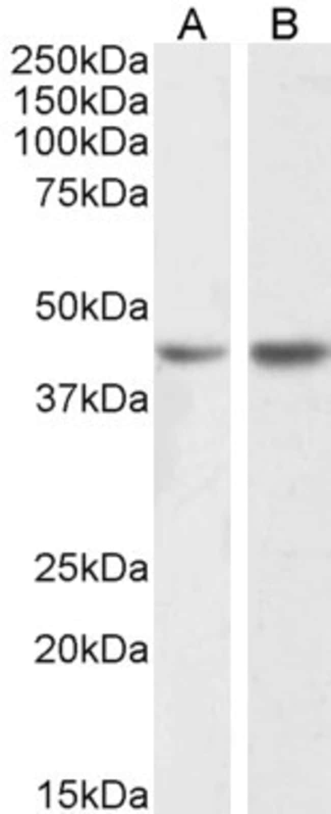 100 UG Podocin / NPHS2 Antibody