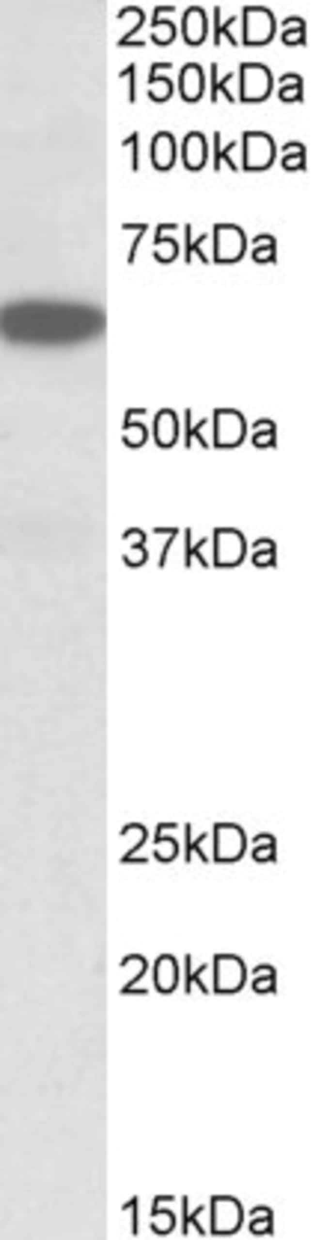100 UG PLA2G4C / cPLA2-gamma Antibody