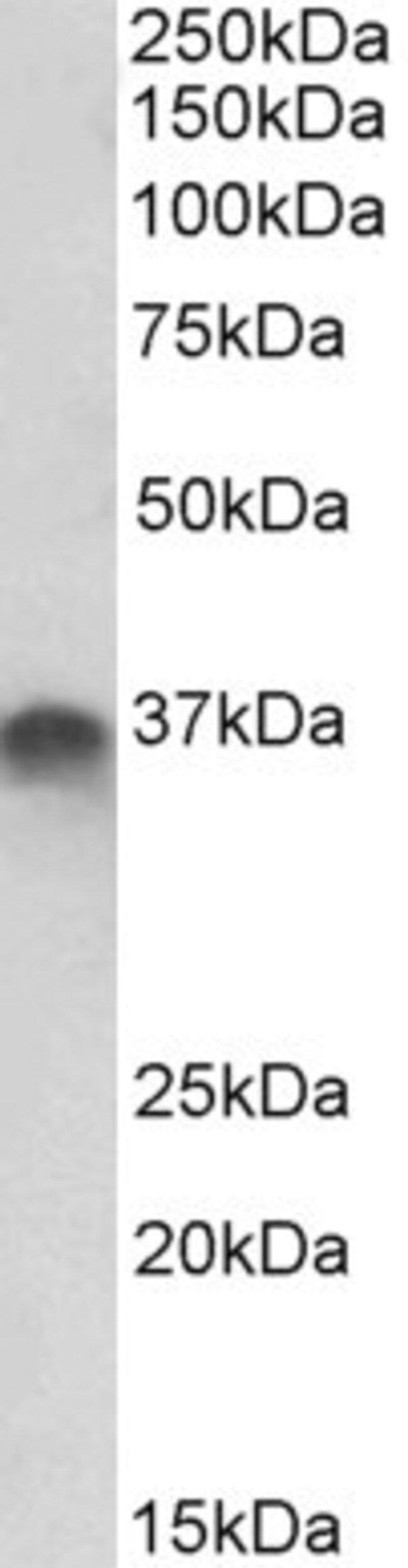 100 UG Syntaxin-11 Antibody