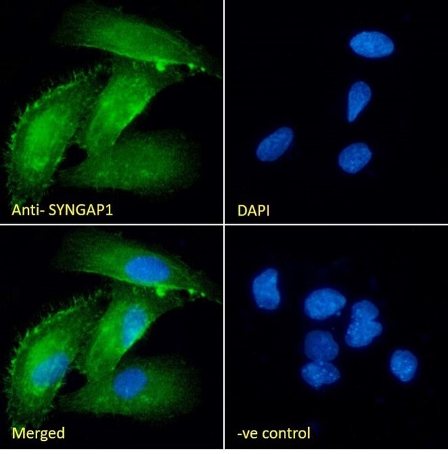 100 UG SynGAP Antibody