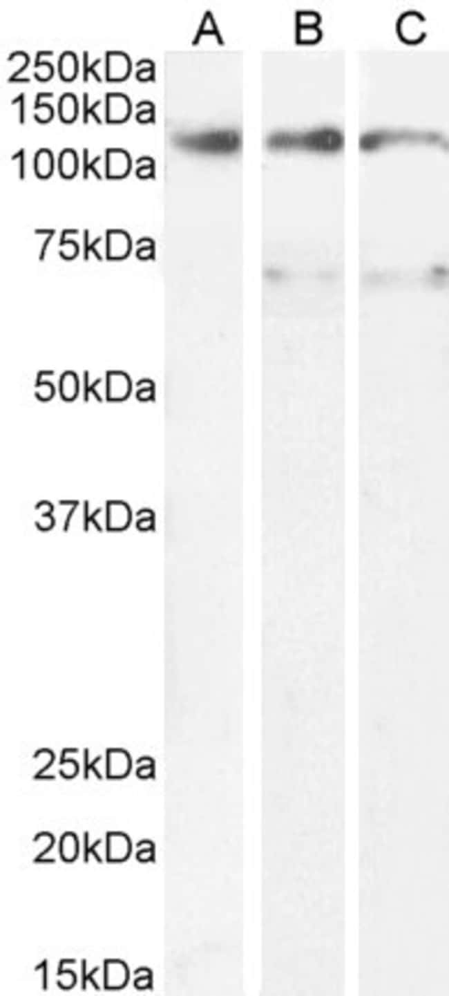 100 UG OSMR / OSMRB Antibody
