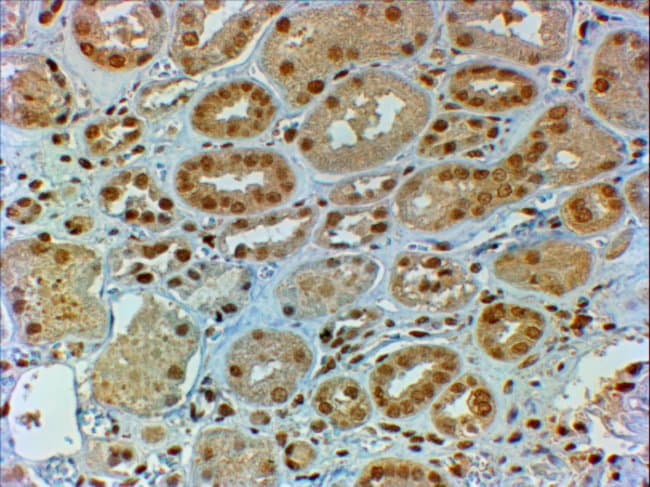 100 UG DMRT2 Antibody