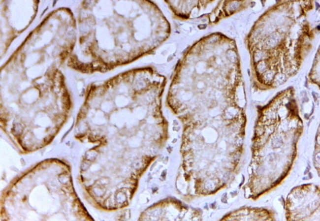 100 UG SLC26A1 / SAT-1 Antibody