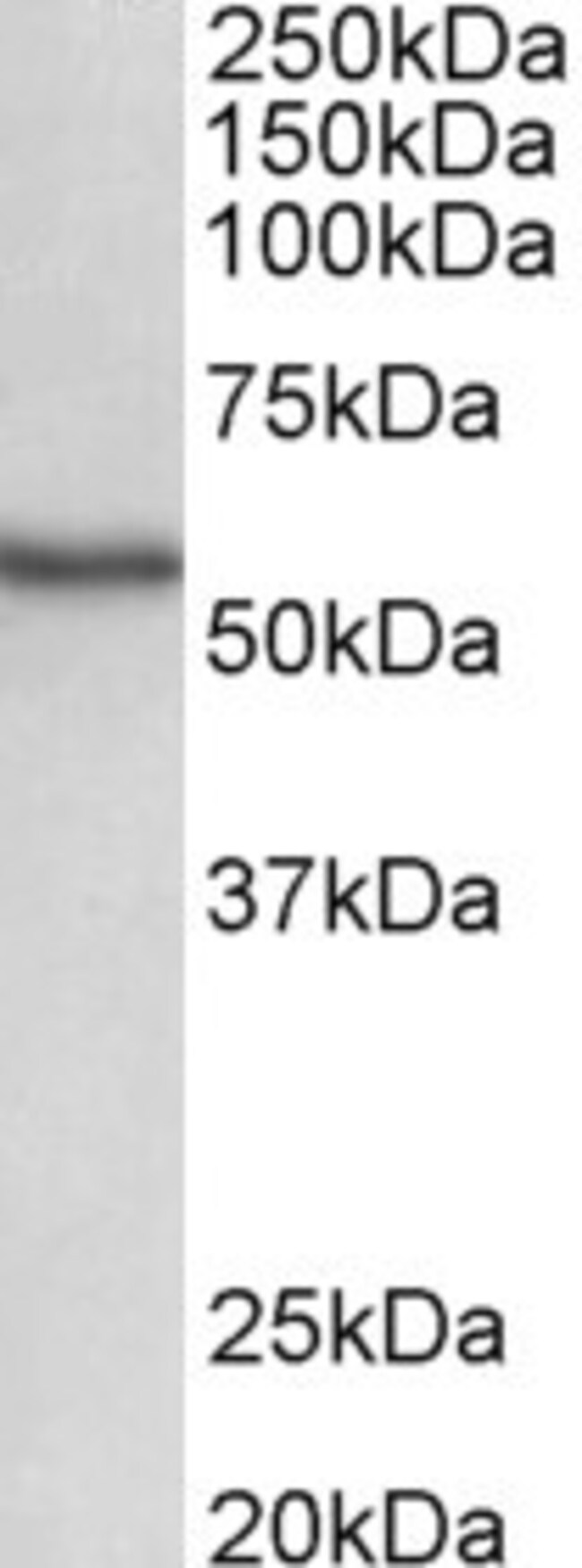 100 UG NDR1 / STK38 Antibody