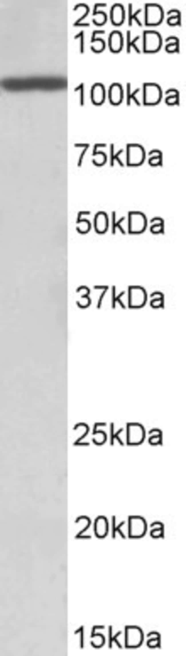 100 UG CCAAT / Enhancer Binding Protein