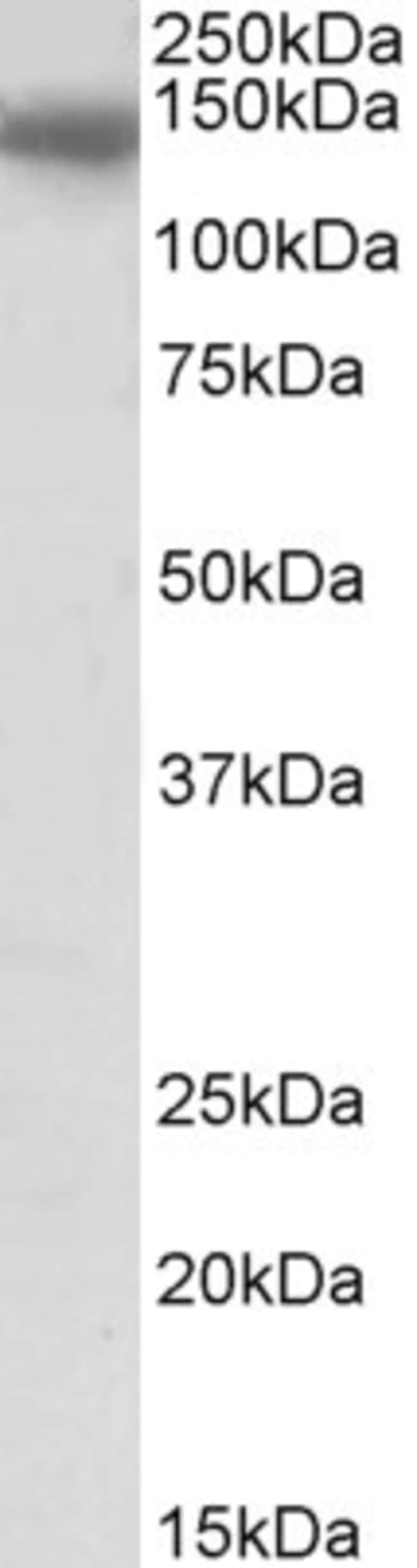 100 UG CCAAT / Enhancer Binding Protein