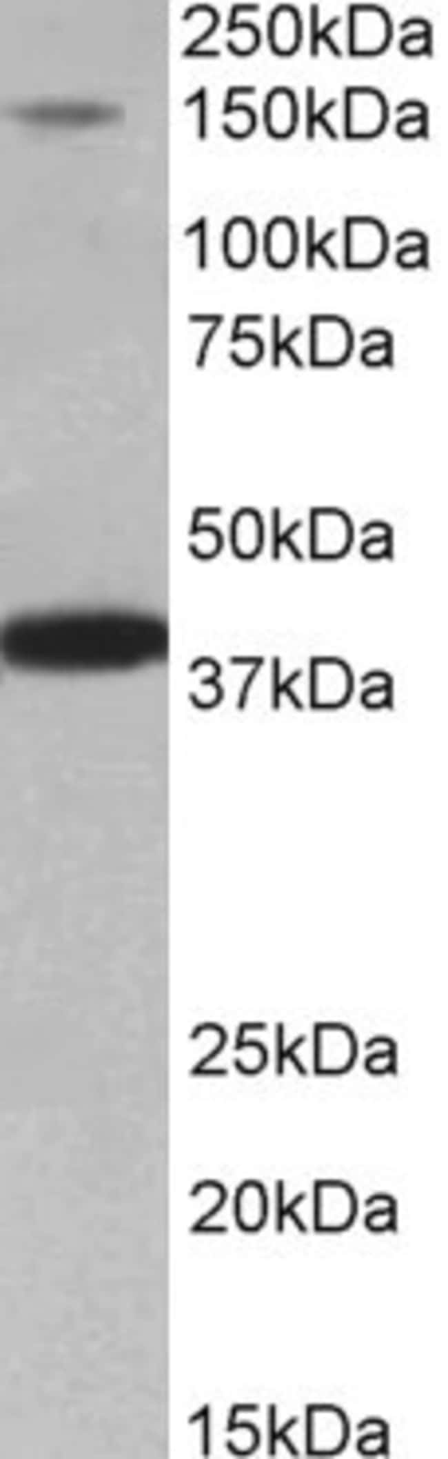 100 UG IRS4 Antibody