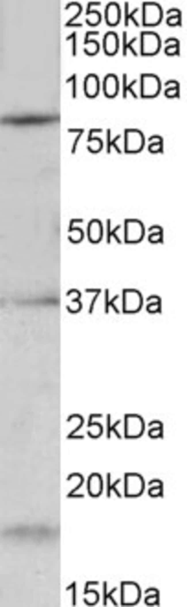 100 UG Kv3.3 / KCNC3 Antibody