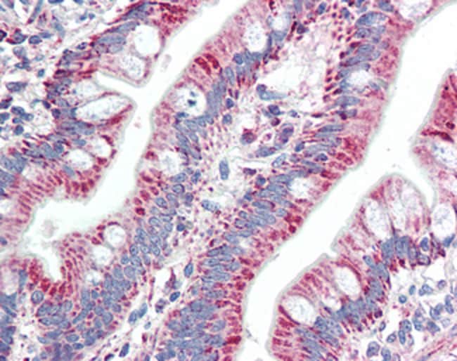 100 UG ZNF652 Antibody