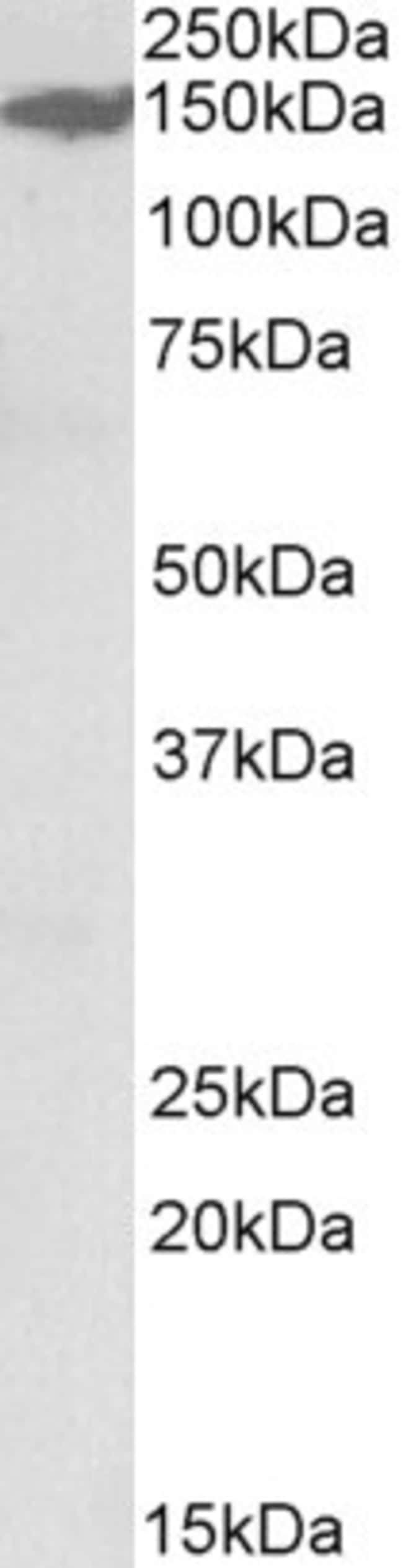 100 UG MAST3 Antibody