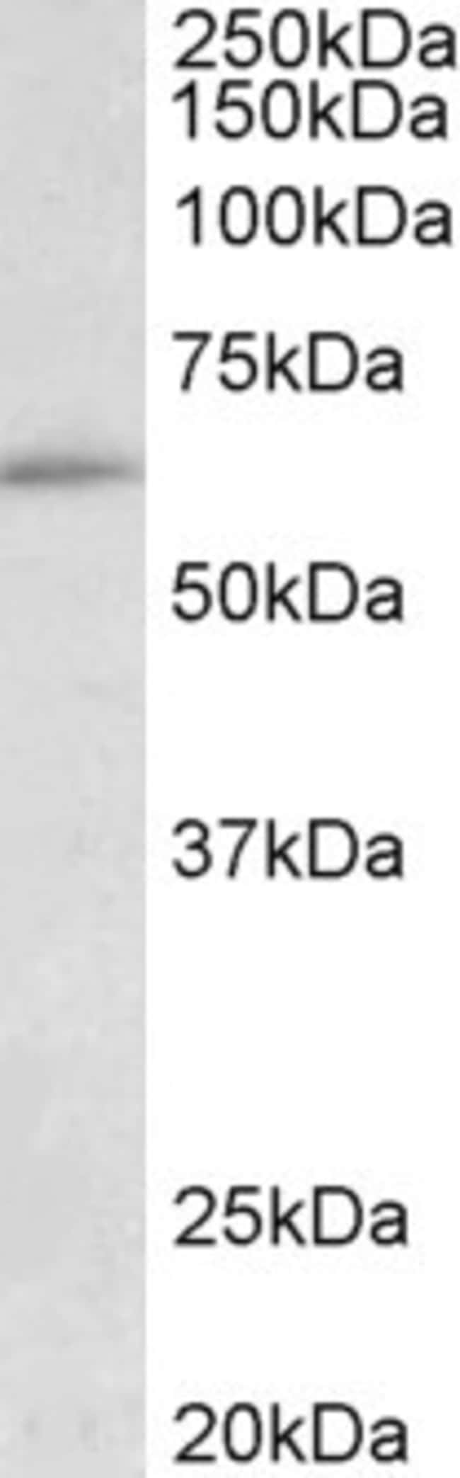 100 UG Hic-2 Antibody