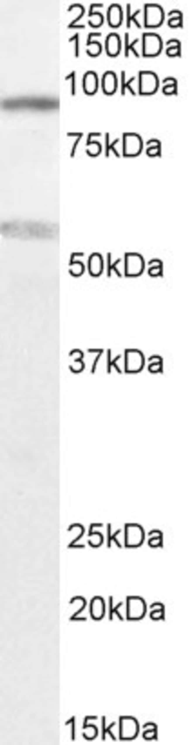 100 UG TBC1D9 Antibody