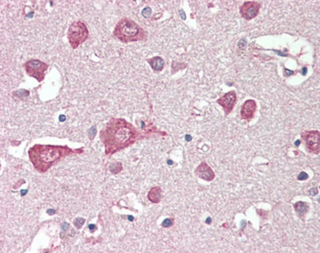 100 UG MLC1 Antibody