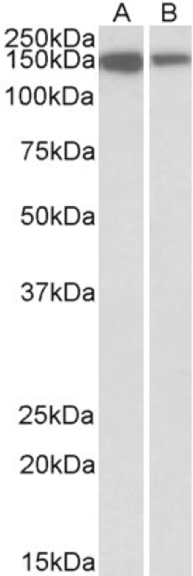 100 UG MCF2L Antibody