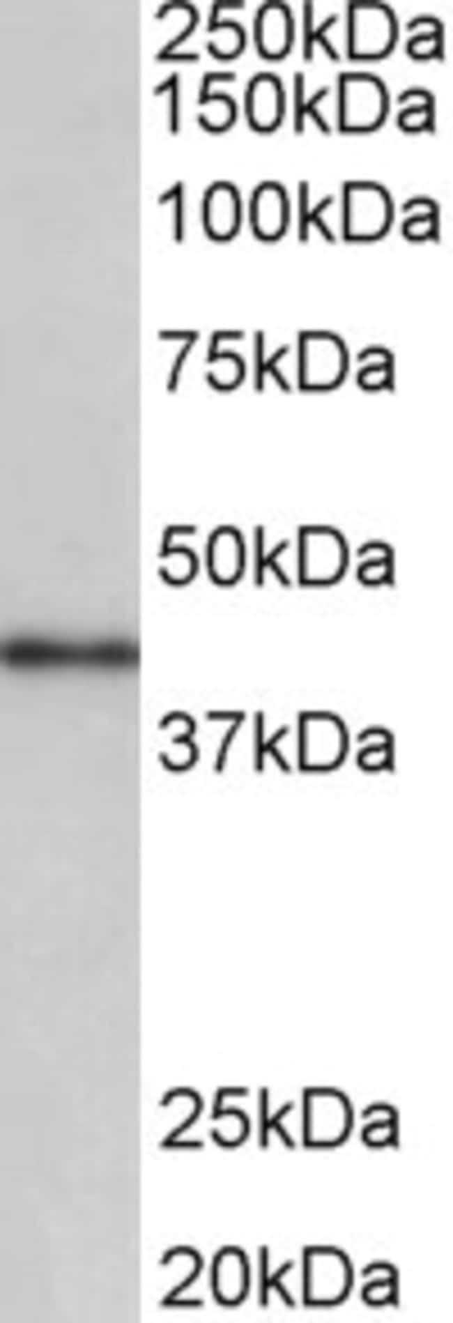 100 UG CCNDBP1 Antibody