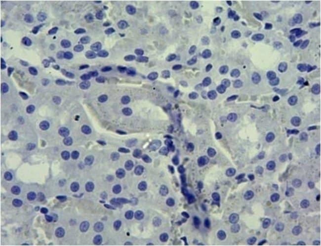 100 UG SLC5A1 / SGLT1 Antibody