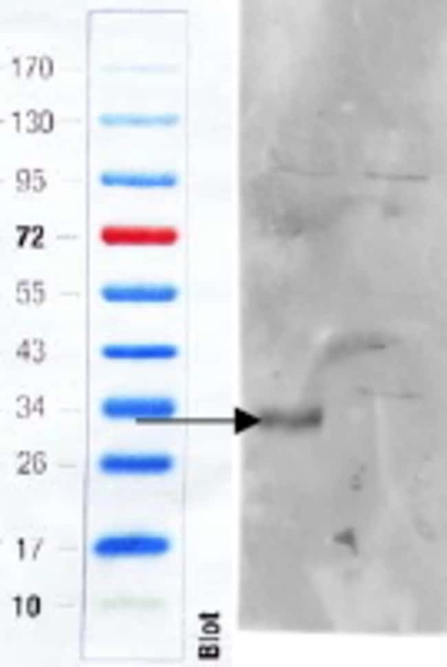 100 UG CD97 Antibody