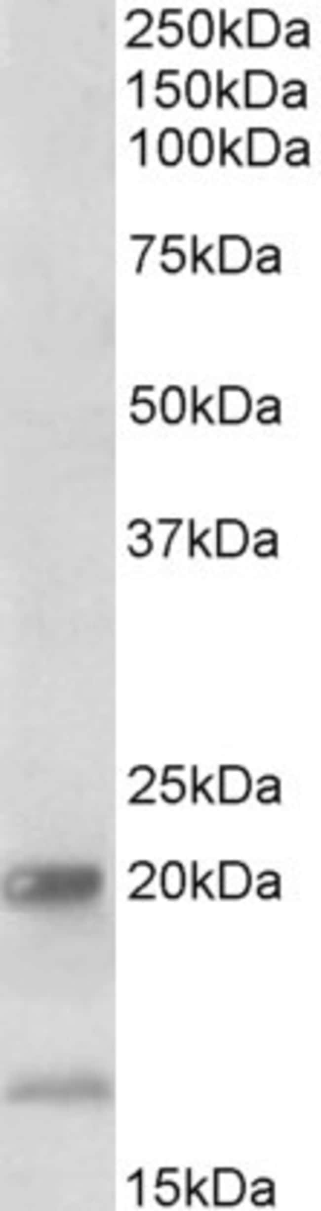 100 UG IL-20 / IL-17B Antibody