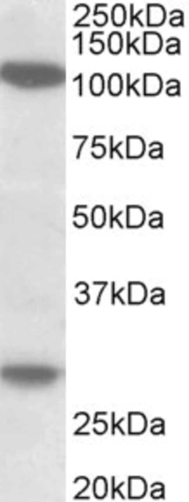 100 UG Ubinuclein-1 + Ubinuclein-2 Antib