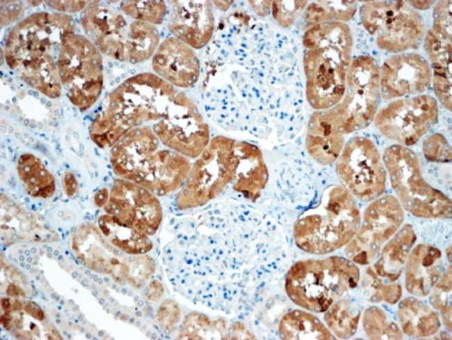 100 UG SOST / Sclerostin Antibody