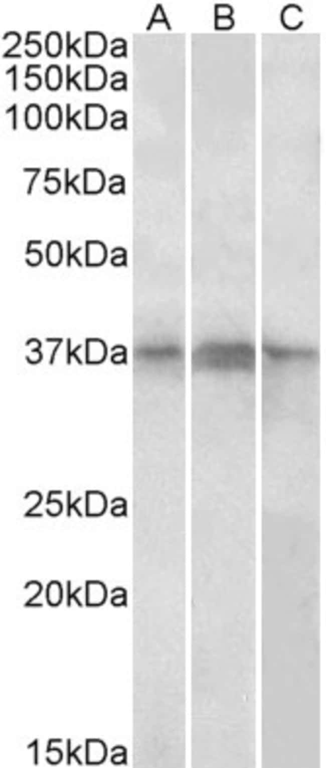 100 UG BCAP / PHF11 Antibody
