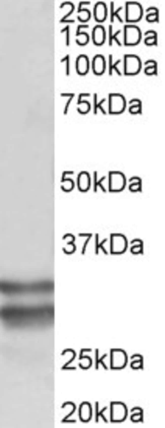 100 UG RFLAT-1 Antibody