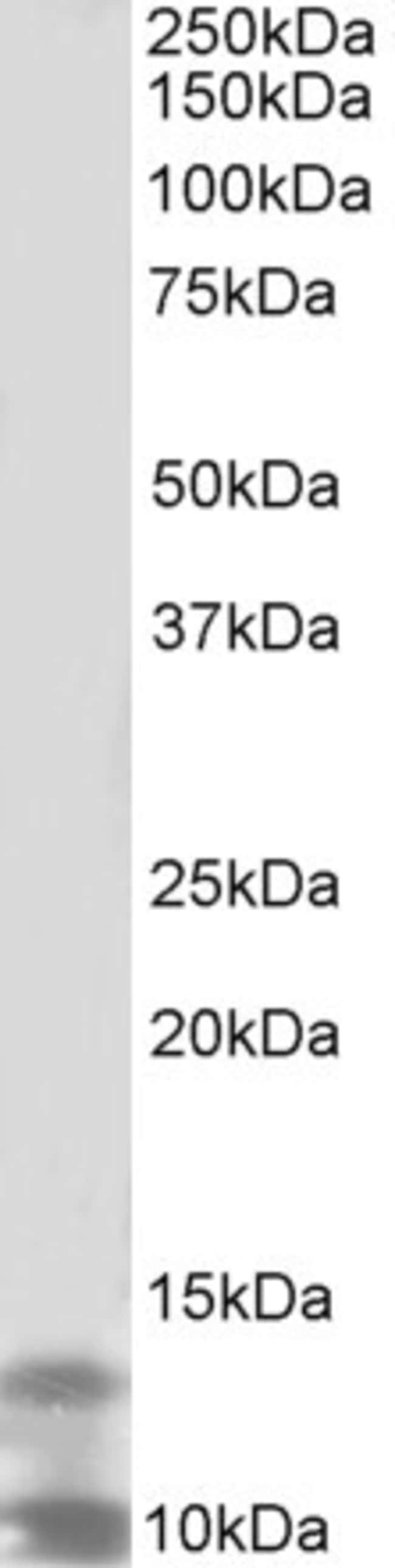 100 UG DPM3 Antibody