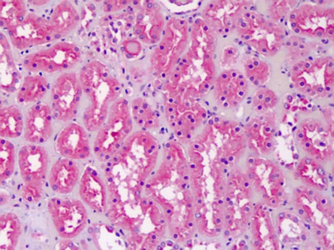 100 UG Cardiolipin Synthase 1 Antibody