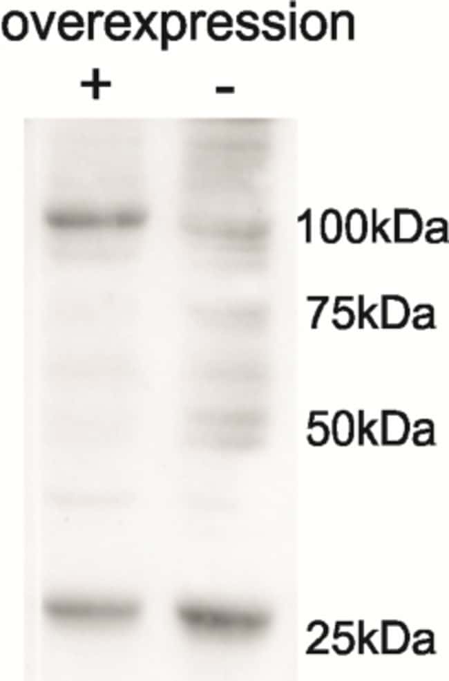 100 UG AARS2 Antibody