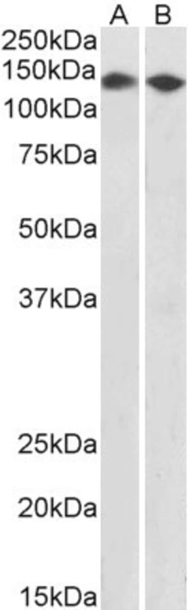 100 UG CCAR2 / DBC1 Antibody