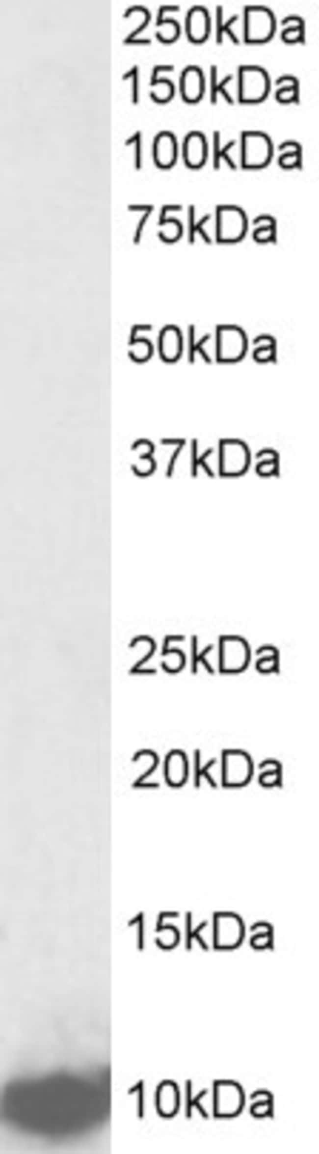 100 UG LSM2 / SNP3 Antibody