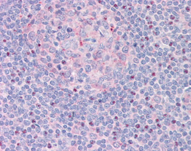 100 UG CTDSP1 / NIF3 Antibody