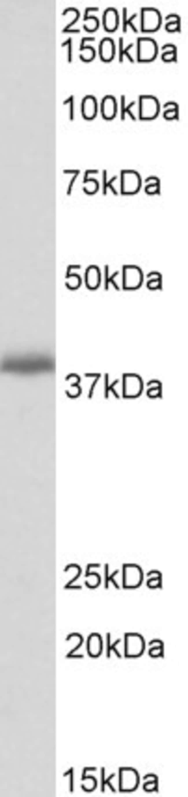 100 UG PDLIM2 Antibody