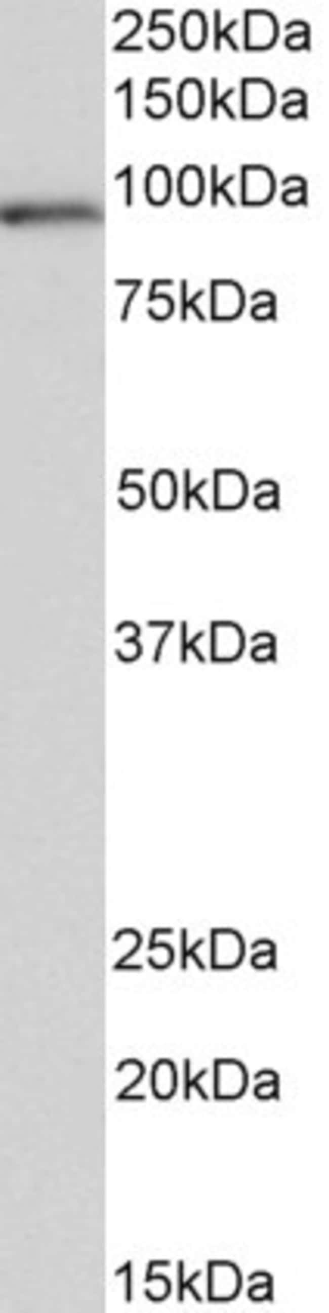 100 UG VPS16 Antibody