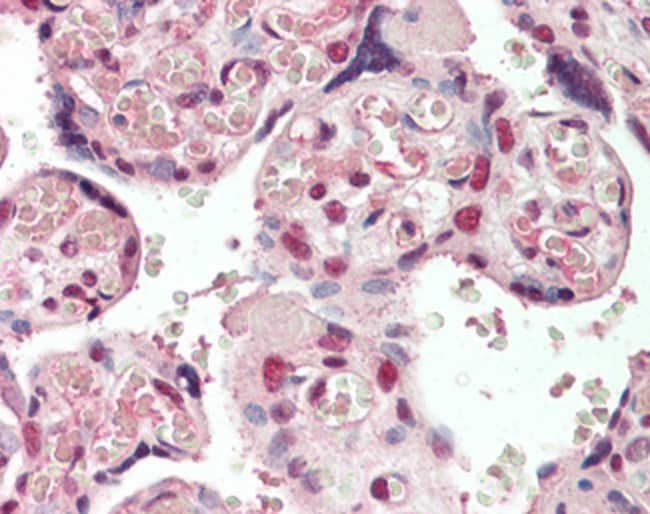 100 UG CREB3L2 / BBF2H7 Antibody