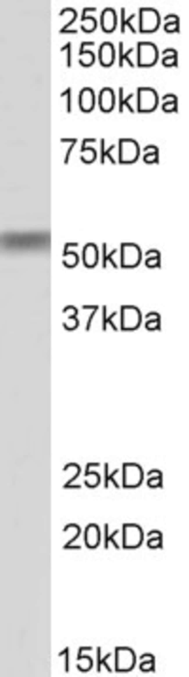 100 UG CREB3L2 / BBF2H7 Antibody