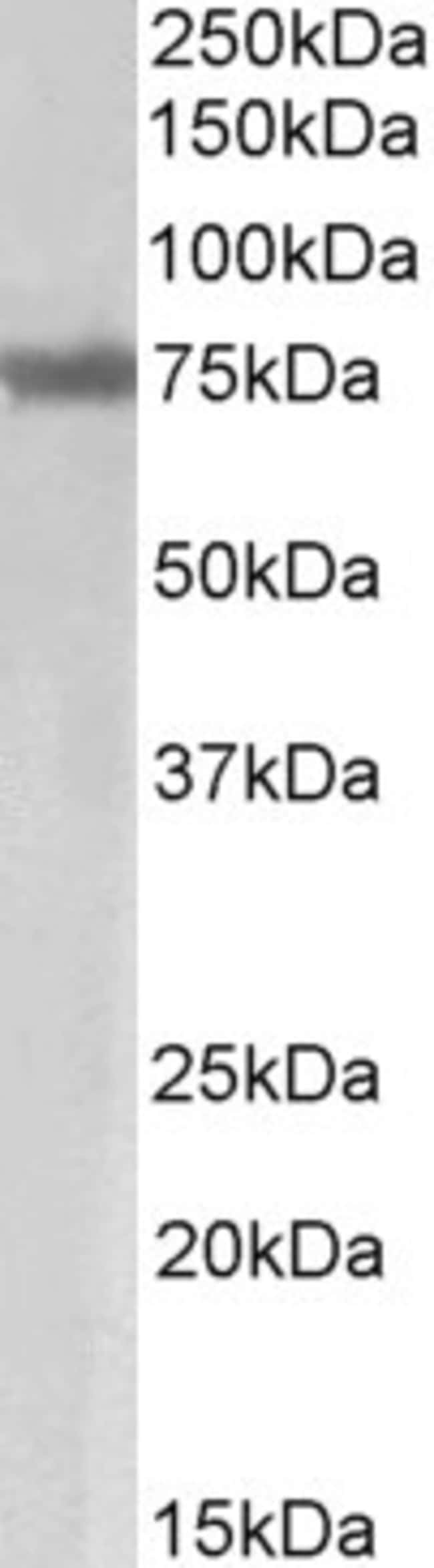 100 UG MARCH7 / Axotrophin Antibody