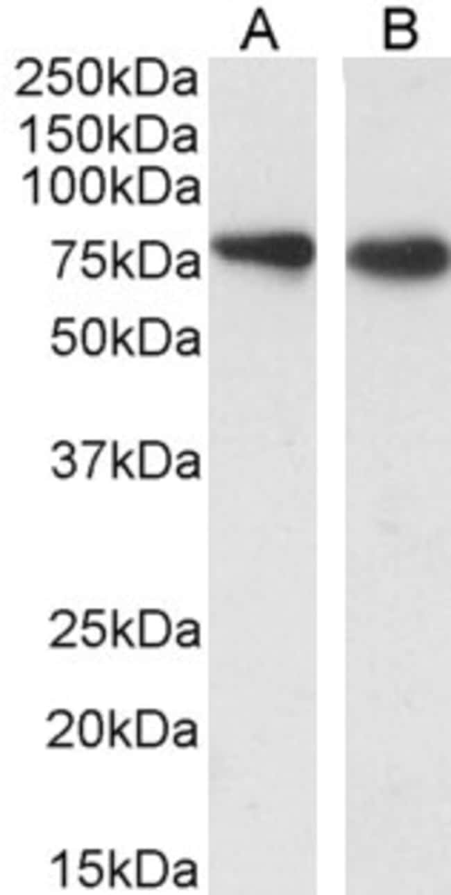 100 UG SLC26A6 Antibody