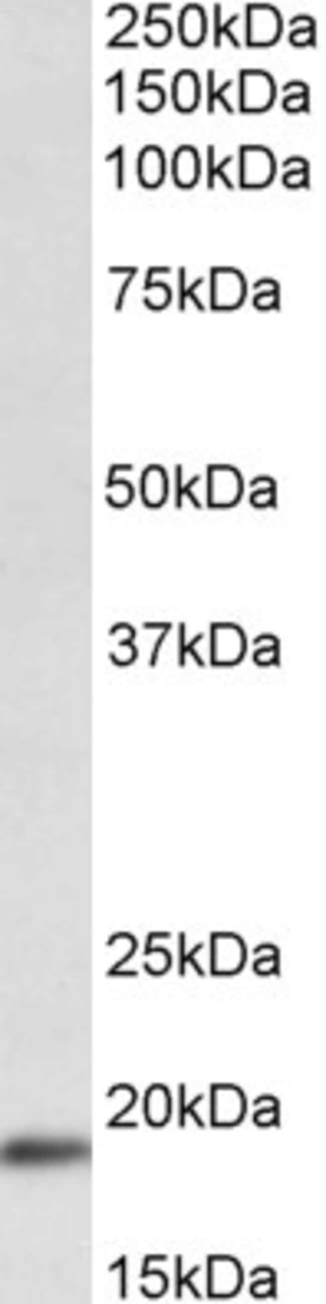 100 UG Wfdc1 Antibody