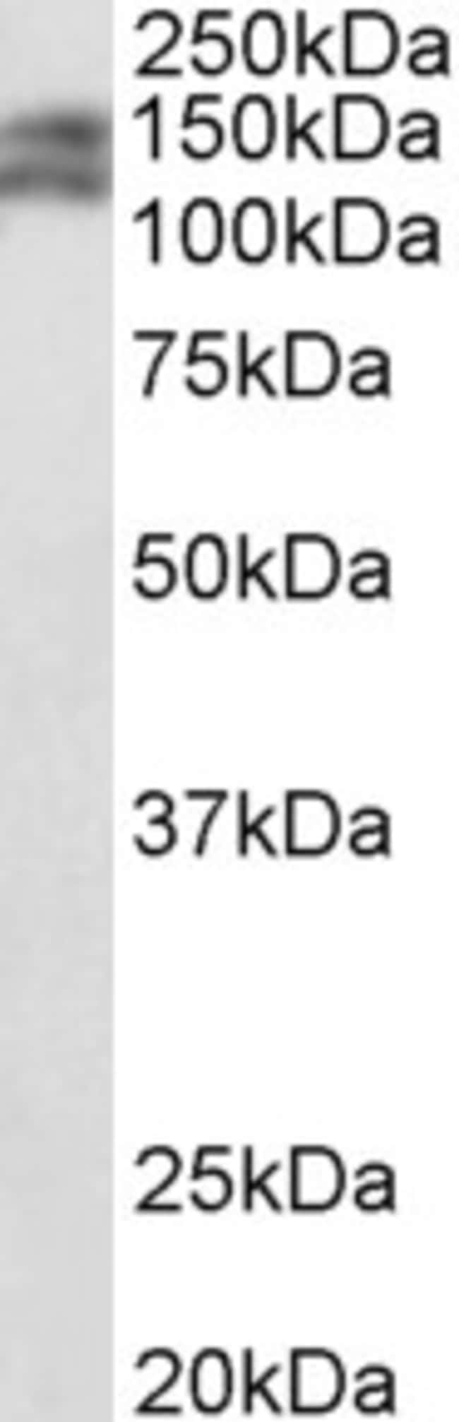 100 UG Pard3b Antibody