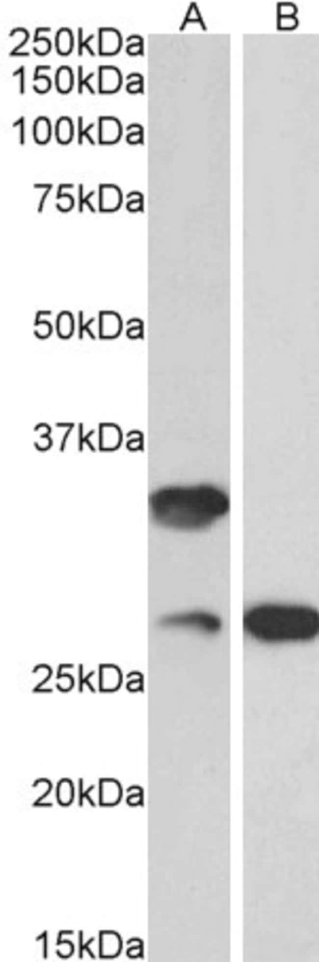 100 UG USB1 / C16orf57 Antibody