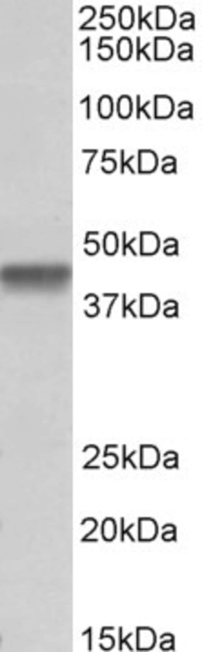 100 UG PTCD2 Antibody
