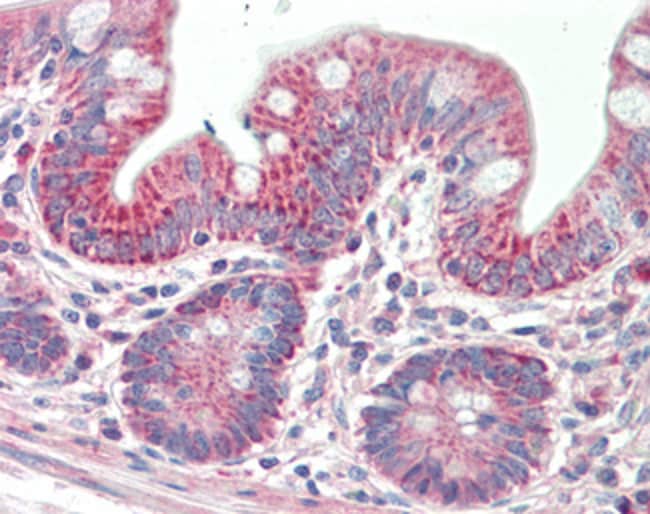 100 UG PTCD2 Antibody