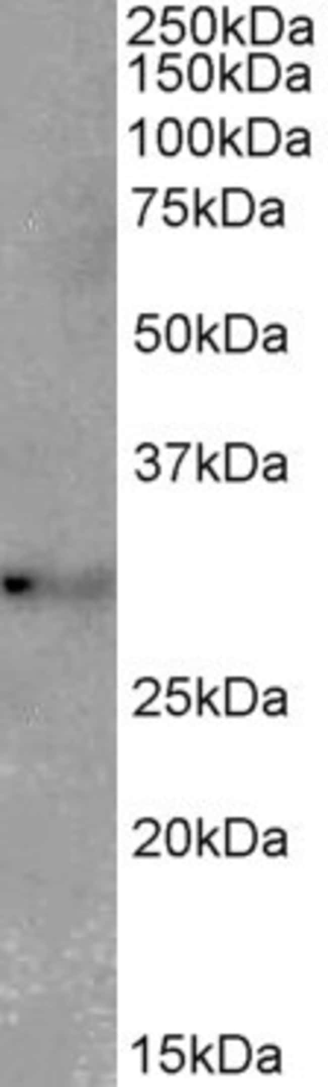 100 UG TSPAN14 Antibody